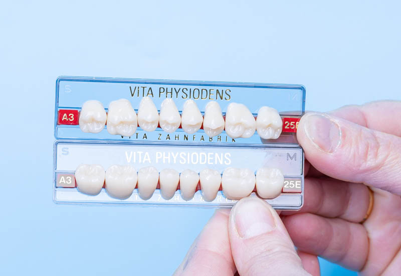 Kronen in verschiedenen Farben aneinander gereiht